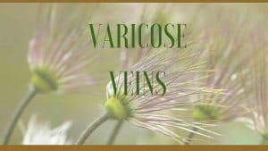 varicose veins herbs